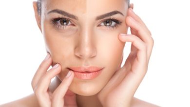 M-tranexamic acid là gì? Công dụng của M-tranexamic acid đối với da