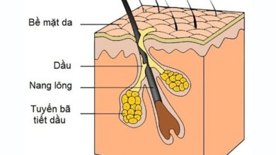 Tuyến bã nhờn chính là thủ phạm gây sợi bã nhờn