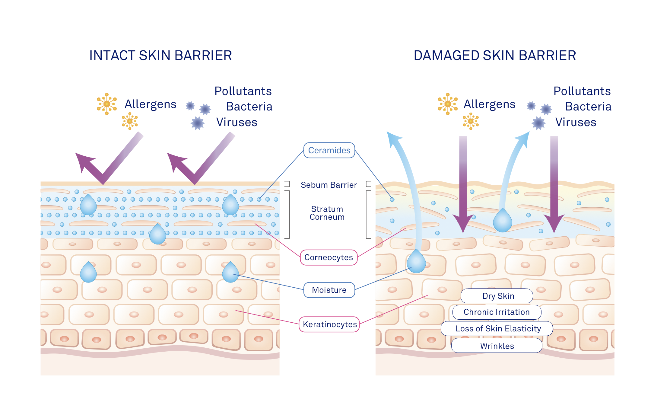 Hàng rào bảo vệ da intact vs damaged skin barrier